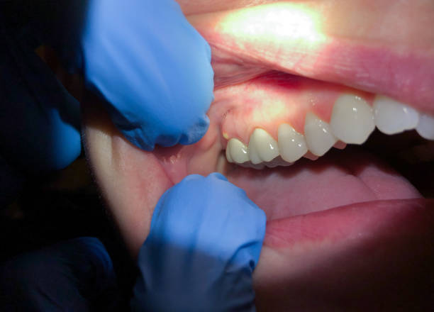 Best Emergency Treatment for Oral Infections in Captain Cook, HI